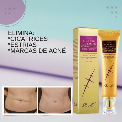 Gel restaurador de Colágeno para cicatrices y  estrias
